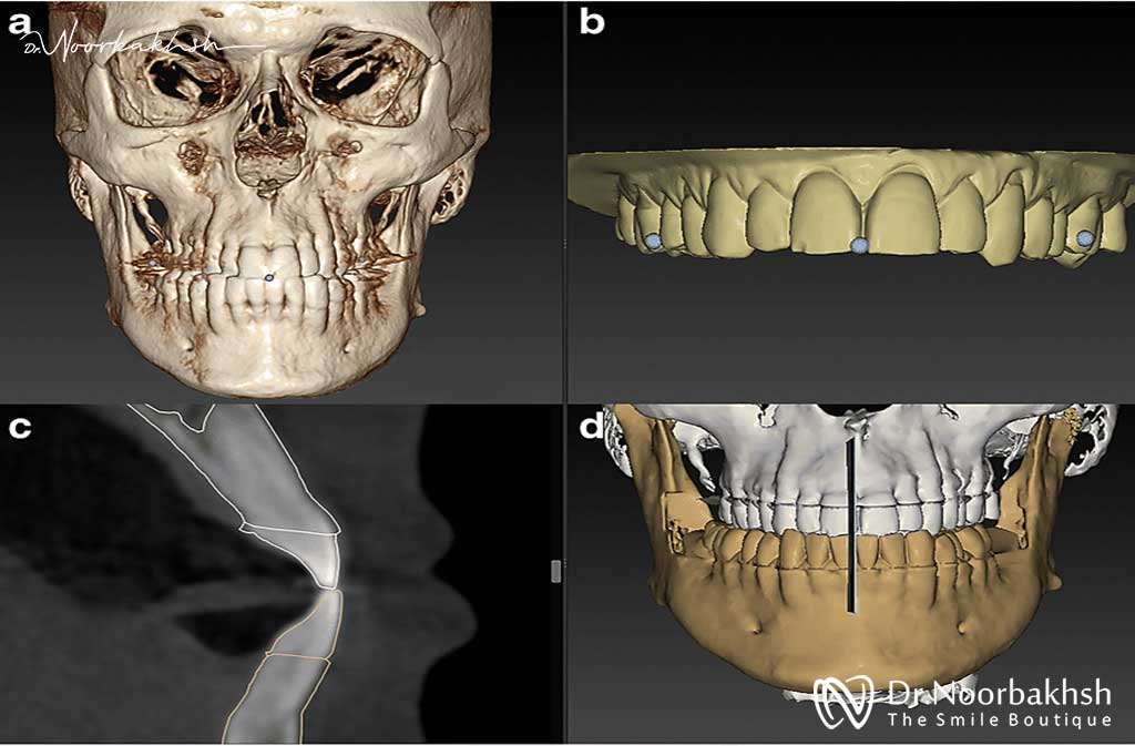 کاربردهای رادیولوژی دندان CBCT