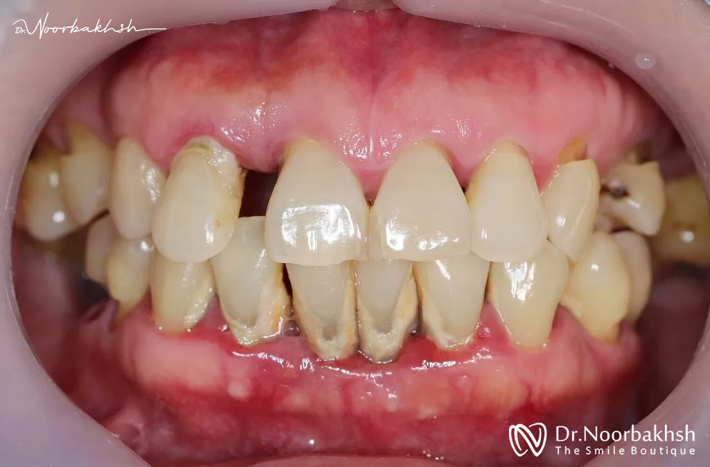 چه زمانی باید به دندانپزشک مراجعه کنیم؟
