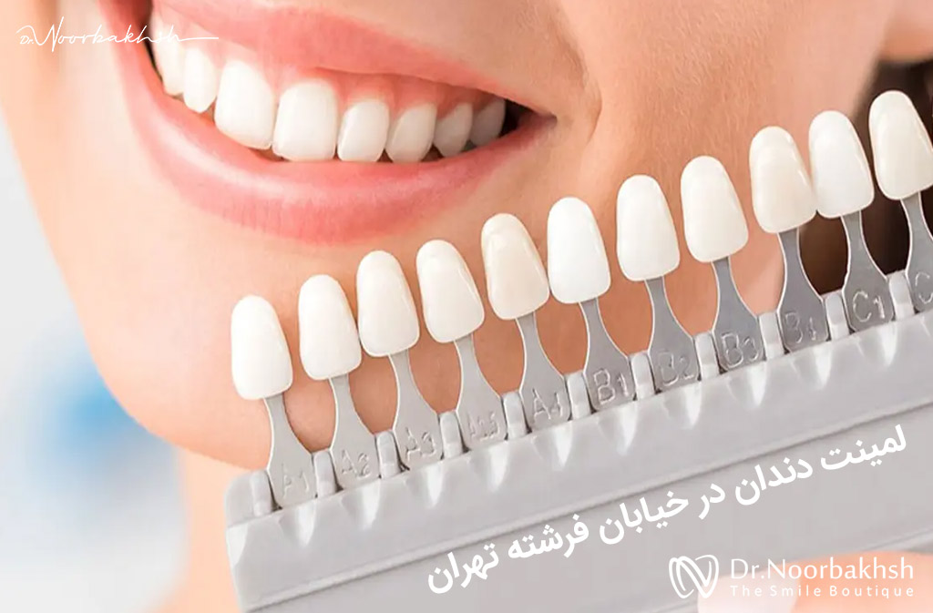 لمینت دندان در خیابان فرشته