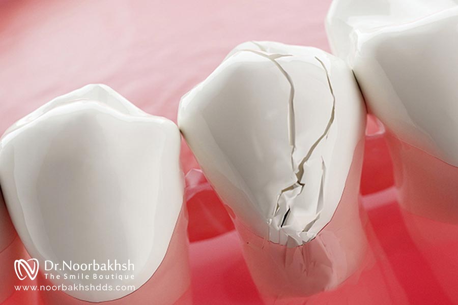 تفاوت درد طبیعی و درد غیرطبیعی پس از عصب کشی