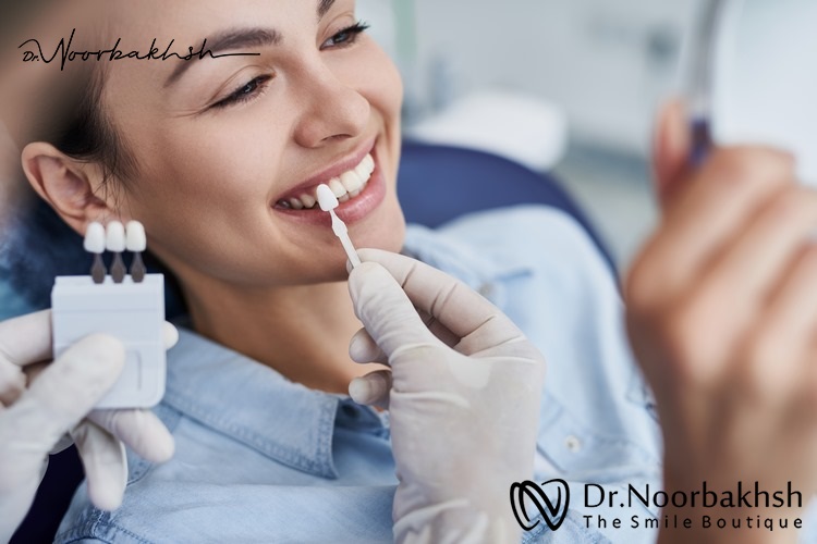 چطور طول عمر کامپوزیت دندان را بیشتر کنیم؟
